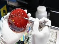 Antibiotika