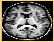 billeddiagnostik