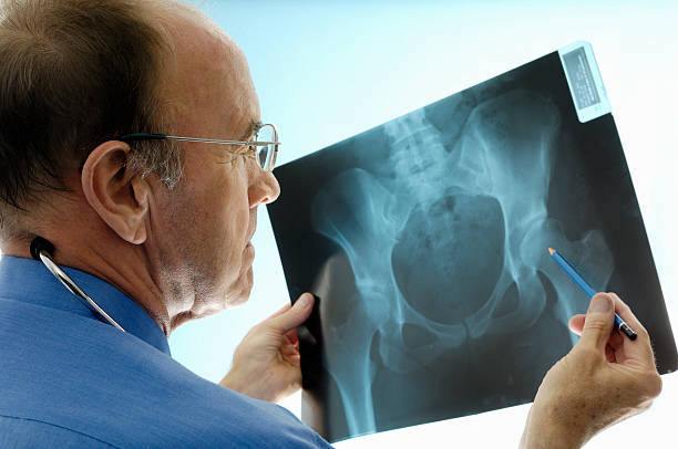 3. slidgigt hvordan stilles diagnosen